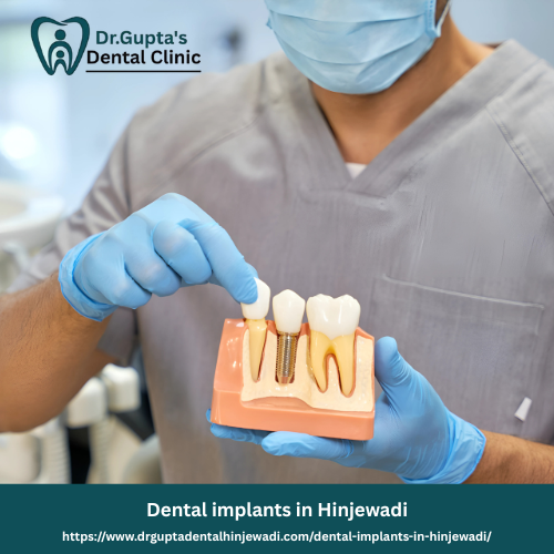 Dental implants in Hinjewadi