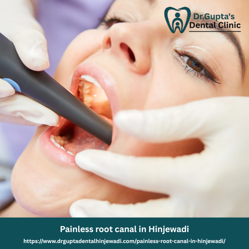Painless root canal in Hinjewadi