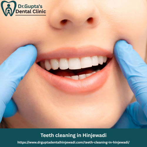 Teeth cleaning in Hinjewadi