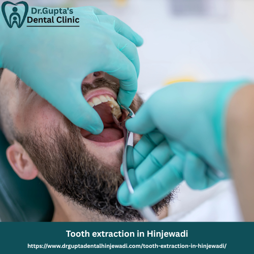 Tooth extraction in Hinjewadi
